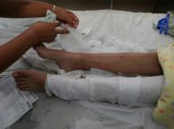 天气原因造成海蜇激增 至少千人受伤 出游下海需谨慎