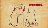 《养生堂》：选鞋选健康