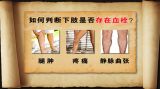 养好双腿人不老（3）