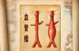 生命管网畅通术（1）