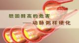 给血管减减“肥”（2）
