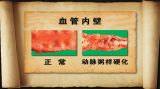 你的血管老了吗（1）