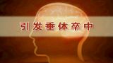 警惕脑中“变异”（2）